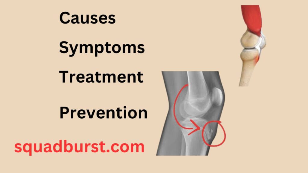 Common Knee Injuries (Especially Among Athletes)